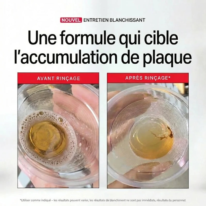 Sourire éclatant résultat
